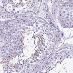 Carboxylesterase 1/CES1 Antibody, Novus Biologicals:Antibodies:Primary
