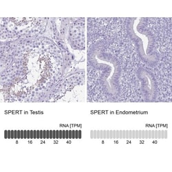 Carboxylesterase 1/CES1 Antibody, Novus Biologicals:Antibodies:Primary