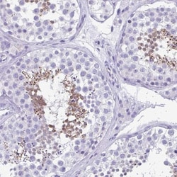 SCUBE3 Antibody, Novus Biologicals:Antibodies:Primary Antibodies
