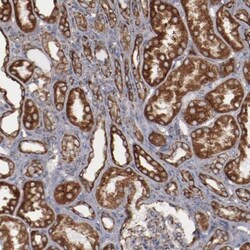 SPFH2 Antibody, Novus Biologicals 25 &mu;L | Buy Online | Novus Biologicals | Fisher Scientific