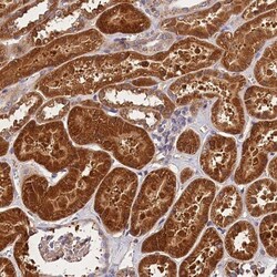 SPG11 Antibody, Novus Biologicals 25 &mu;L | Buy Online | Novus Biologicals | Fisher Scientific