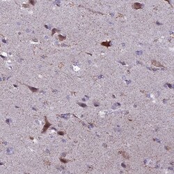 SPHKAP Antibody, Novus Biologicals 0.1mL; Unlabeled:Antibodies, Polyclonal