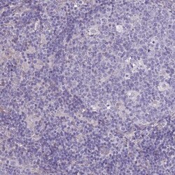 SPHKAP Antibody, Novus Biologicals 0.1mL; Unlabeled:Antibodies, Polyclonal