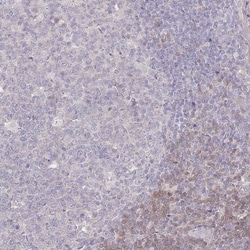 SPHKAP Antibody, Novus Biologicals:Antibodies:Primary Antibodies