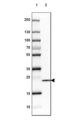 SPINK13 Antibody, Novus Biologicals:Antibodies:Primary Antibodies
