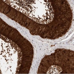 SPINK2 Antibody, Novus Biologicals:Antibodies:Primary Antibodies