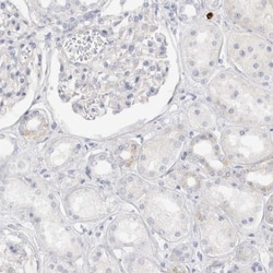 SPINK2 Antibody, Novus Biologicals:Antibodies:Primary Antibodies