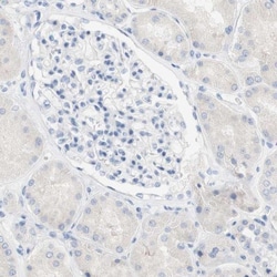SPINK5 Antibody, Novus Biologicals:Antibodies:Primary Antibodies