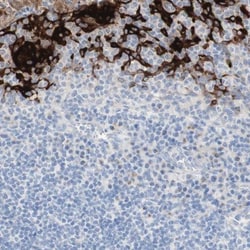 SPINK5 Antibody, Novus Biologicals:Antibodies:Primary Antibodies