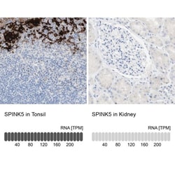 SPINK5 Antibody, Novus Biologicals:Antibodies:Primary Antibodies