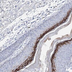 SPINK7 Antibody, Novus Biologicals:Antibodies:Primary Antibodies