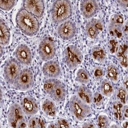 SPIRE2 Antibody, Novus Biologicals 0.1mL; Unlabeled:Antibodies, Polyclonal