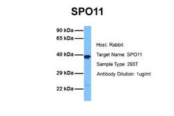 SPO11 Antibody, Novus Biologicals 0.05mg; Unlabeled:Antibodies, Polyclonal