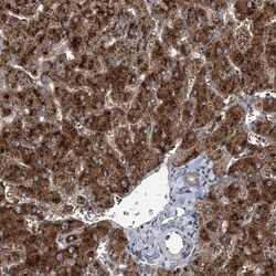 ODF2 Antibody, Novus Biologicals:Antibodies:Primary Antibodies