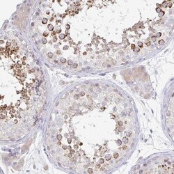 SPPL3 Antibody, Novus Biologicals 0.1mL; Unlabeled:Antibodies, Polyclonal