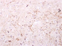 SPR Antibody, Novus Biologicals 0.1mg; Unlabeled:Antibodies, Polyclonal