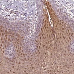 SPRR3 Antibody, Novus Biologicals:Antibodies:Primary Antibodies