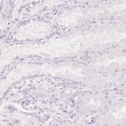 SPRR3 Antibody, Novus Biologicals:Antibodies:Primary Antibodies
