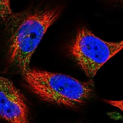 SPRYD7 Antibody, Novus Biologicals:Antibodies:Primary Antibodies