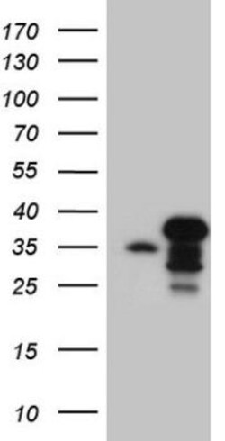 SPT3 Antibody (OTI1A5), Novus Biologicals 0.1 mL | Buy Online | Novus Biologicals | Fisher Scientific
