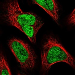 SPT3 Antibody, Novus Biologicals 0.1mL; Unlabeled:Antibodies, Polyclonal