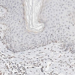 SPT3 Antibody, Novus Biologicals 0.1mL; Unlabeled:Antibodies, Polyclonal