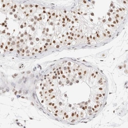 SPT3 Antibody, Novus Biologicals 0.1mL; Unlabeled:Antibodies, Polyclonal