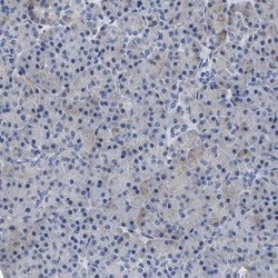 SQLE Antibody, Novus Biologicals 0.1mL; Unlabeled:Antibodies, Polyclonal