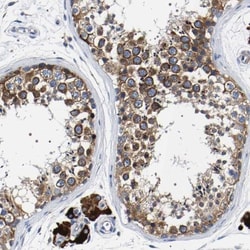SQLE Antibody, Novus Biologicals 0.1mL; Unlabeled:Antibodies, Polyclonal