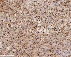 SR-BI Antibody, Novus Biologicals 0.025mL; Unlabeled:Antibodies, Polyclonal