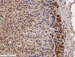SR-BI Antibody, Novus Biologicals 0.025mL; Unlabeled:Antibodies, Polyclonal