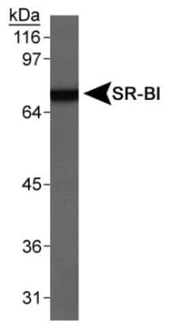 SR-BI Antibody, Novus Biologicals 0.025mL; Unlabeled:Antibodies, Polyclonal