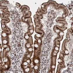 SR140 Antibody, Novus Biologicals 0.1mL; Unlabeled:Antibodies, Polyclonal