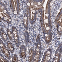 SRBD1 Antibody, Novus Biologicals:Antibodies:Primary Antibodies