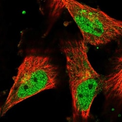SRCAP Antibody, Novus Biologicals 25 &mu;L; Unlabeled:Antibodies, Polyclonal