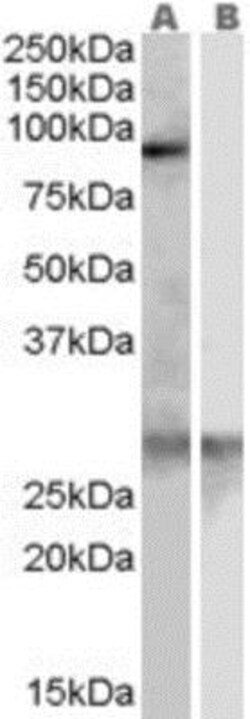 SREC-I/SCARF1 Antibody, Novus Biologicals 0.1mg; Unlabeled:Antibodies,