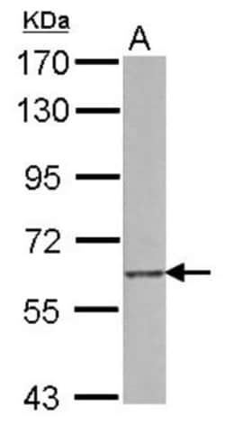 SREC-I/SCARF1 Antibody, Novus Biologicals 0.1mL; Unlabeled:Antibodies,