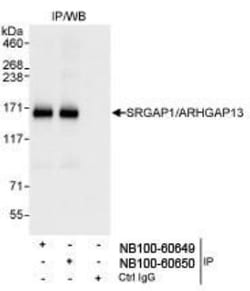 SRGAP1 Antibody, Novus Biologicals 100 &mu;L | Buy Online | Novus Biologicals | Fisher Scientific