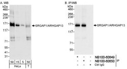 SRGAP1 Antibody, Novus Biologicals 0.1mL; Unlabeled:Antibodies, Polyclonal