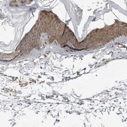 SRGAP2 Antibody, Novus Biologicals:Antibodies:Primary Antibodies