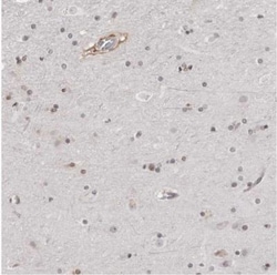 SRGAP2 Antibody, Novus Biologicals 0.1mL; Unlabeled:Antibodies, Polyclonal