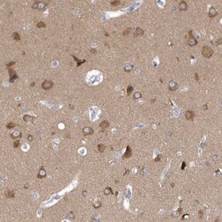 SRGAP3 Antibody, Novus Biologicals 0.1mL; Unlabeled:Antibodies, Polyclonal