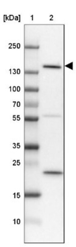 SRGAP3 Antibody, Novus Biologicals 0.1mL; Unlabeled:Antibodies, Polyclonal