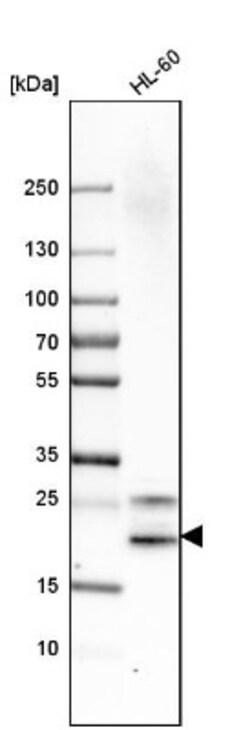 SRGN Antibody, Novus Biologicals 25ul | Buy Online | Novus Biologicals | Fisher Scientific