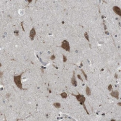 SRPK2 Antibody, Novus Biologicals 0.1mL; Unlabeled:Antibodies, Polyclonal