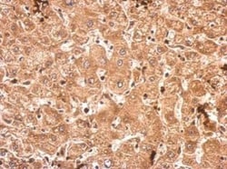 SRPK3/STK23 Antibody, Novus Biologicals 0.1mL; Unlabeled:Antibodies, Polyclonal