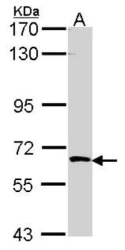 SRPK3/STK23 Antibody, Novus Biologicals 0.1mL; Unlabeled:Antibodies, Polyclonal