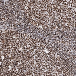 SRp55 Antibody, Novus Biologicals 0.1mL; Unlabeled:Antibodies, Polyclonal