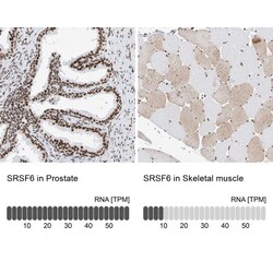 SRp55 Antibody, Novus Biologicals 0.1mL; Unlabeled:Antibodies, Polyclonal