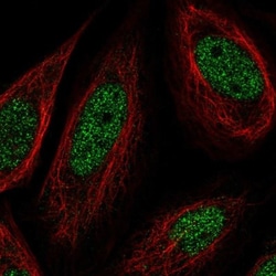 SS18 Antibody, Novus Biologicals:Antibodies:Primary Antibodies